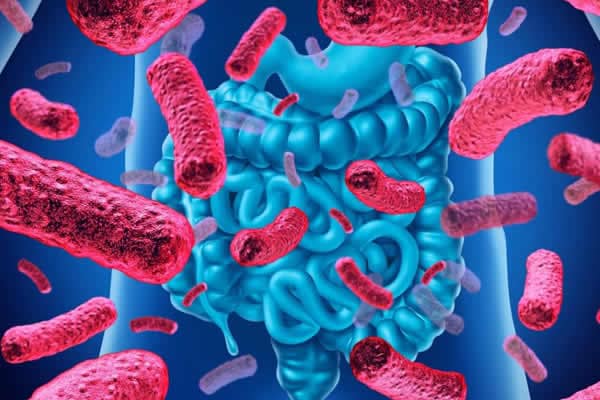 What Causes Leaky Gut? 1 What Causes Leaky Gut?