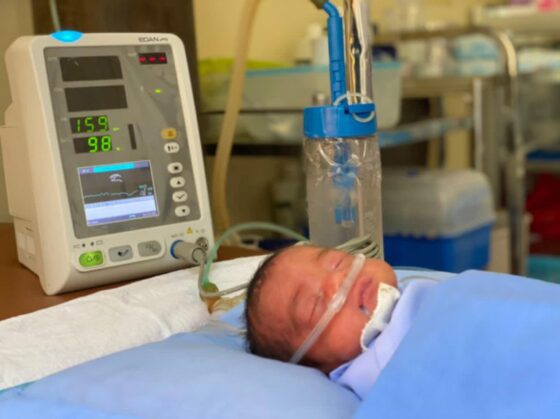 bubble cpap