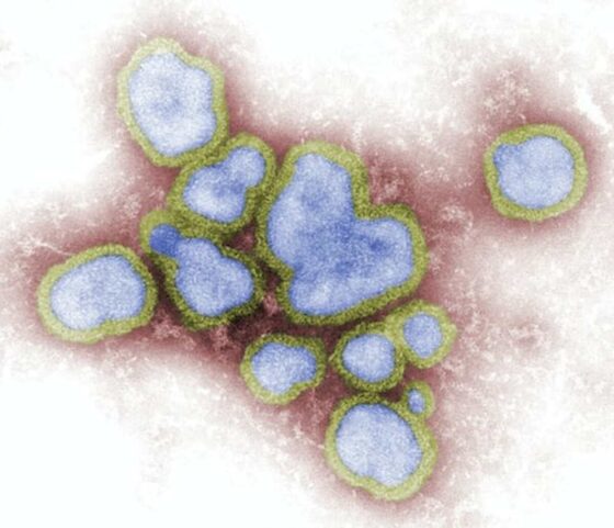 influenza