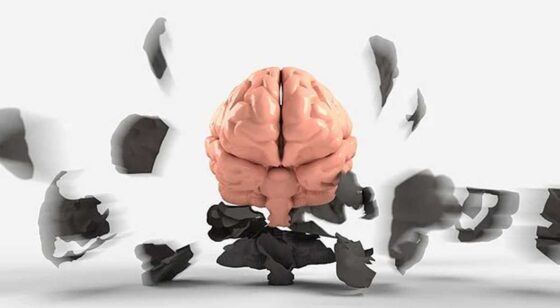 brain 3439067 340