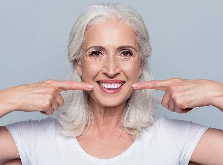Can fillers remove marionette lines