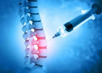 Radiofrequency Ablation vs. Steroid Injection