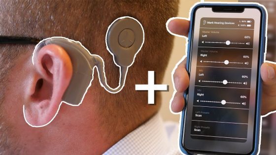 cochlear implant android app for tinnitus