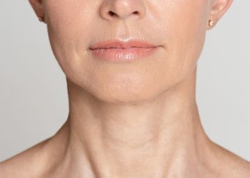 nefertiti neck lift