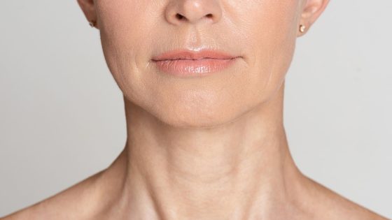 nefertiti neck lift